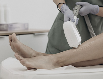Depilação a laser na JB Estética